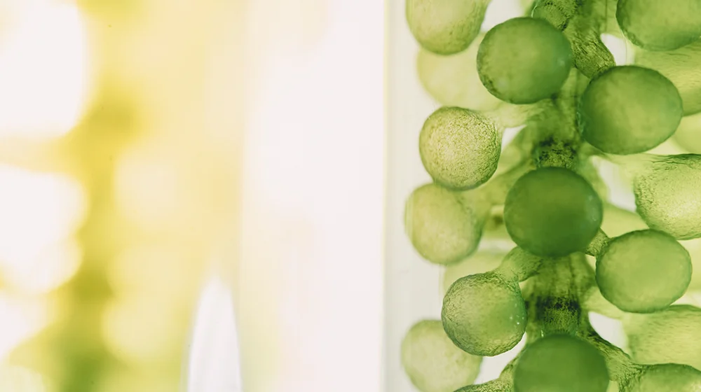 Microalgae cells forming a bead-like chain under a microscope.